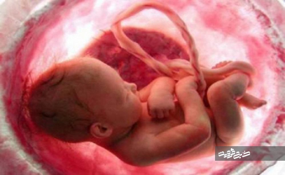 ژست عجیب جنین درون شکم مادرش + عکس