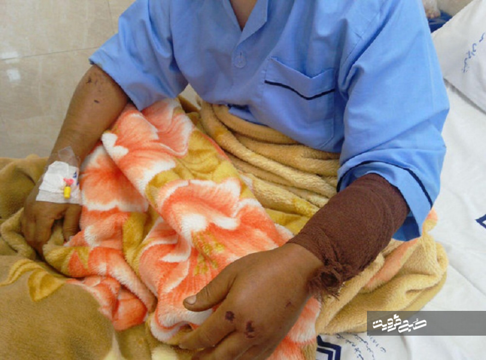 حمله سگ گرگی مرد ۵۱ ساله قزوینی را راهی بیمارستان کرد‌