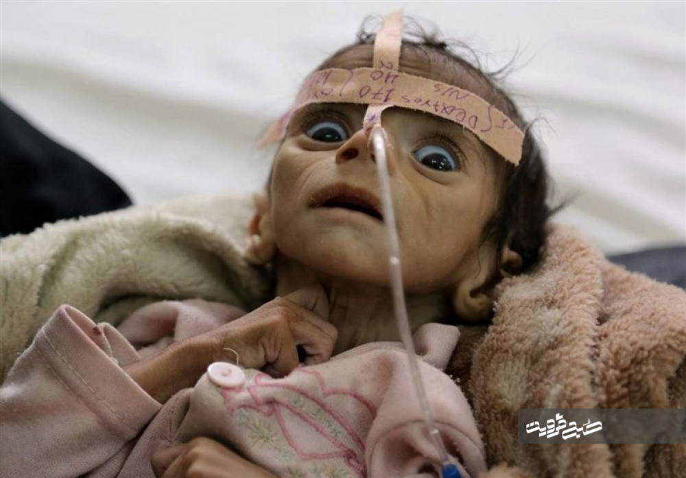 ۵ هزار کودک یمنی از آغاز جنگ عربستان کشته و زخمی شده‌اند