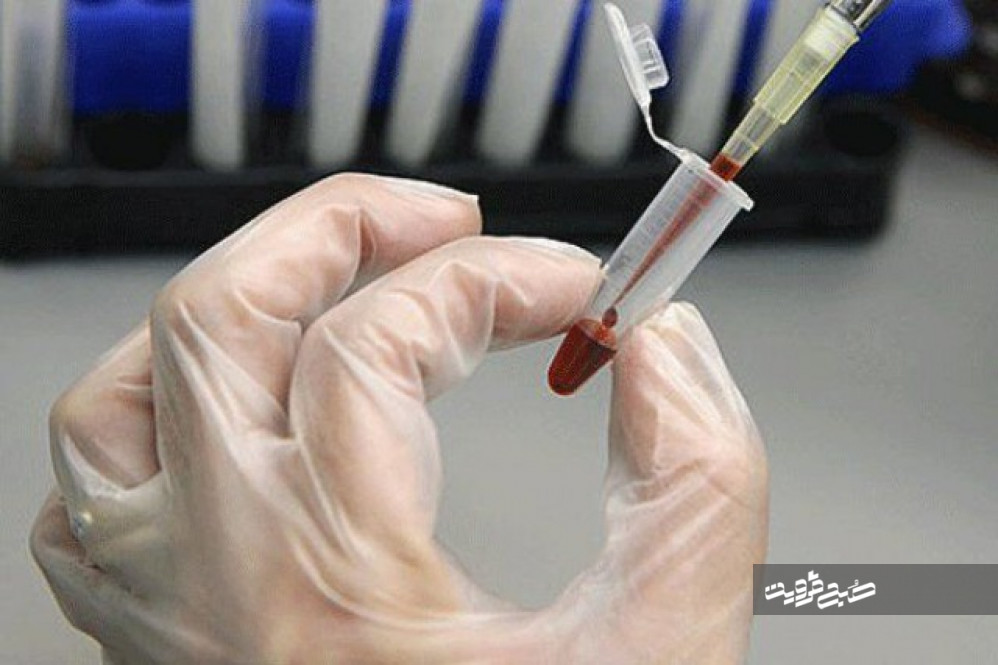 ذخیره ۱۲۰۰ نمونه خون بند ناف نوزاد در قزوین